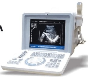 Oriel-Plus-Ultrasound-Machine